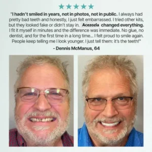 🏮2026 New Year Hot Sale - 🏆 Ends Today: 70% OFF! 🦷 Acezozla™ Custom-Fit Fully Functional Dentures for a More Confident Smile!