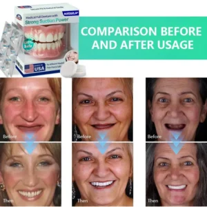 ✨Ends Today: 70% OFF! ⏰Acezozla® Medical Full Denture with Strong Suction ✅ (Made and Shipped from the USA🍀)