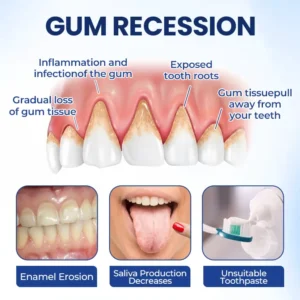 ACEZOZLA® BeeTakt Oral Repair Solution