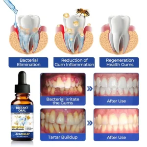 ACEZOZLA® BeeTakt Oral Repair Solution
