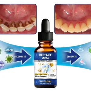 ACEZOZLA® BeeTakt Oral Repair Solution