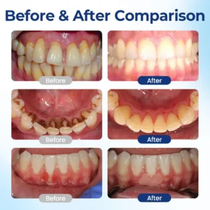 ACEZOZLA® BeeTakt Oral Repair Solution