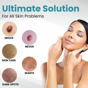 ACEZOZLA™ non-invasive laser pen delivers hospital-grade results at home