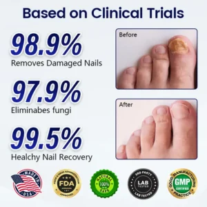 Acezozla® Anti-Fungal Nail Repair Patch