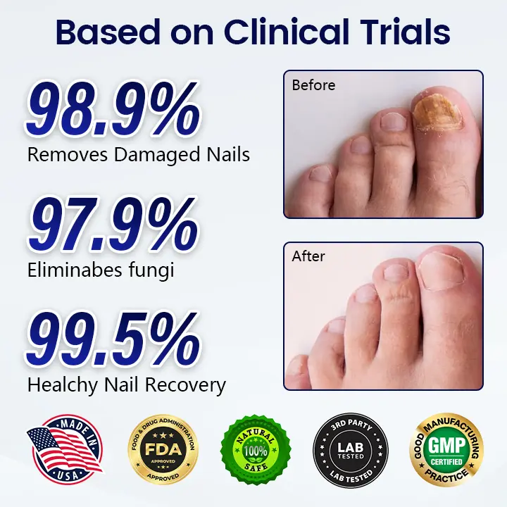 Acezozla® Anti-Fungal Nail Repair Patch