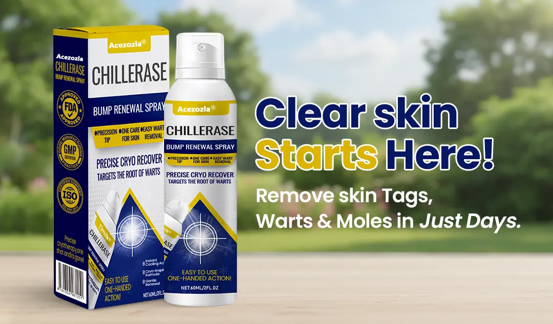 Acezozla® ChillErase Bump Renewal Spray
