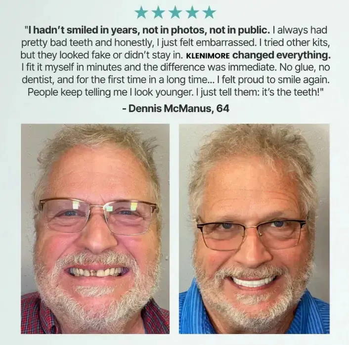 🏆Acezozla™: 😁Dentures That Stay. Smile With Confidence😁