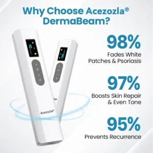 Acezozla® DermaBeam Vitiligo Therapy Device 3-5 Second Vitiligo Treatment, Visible Results in Just 2 Weeks