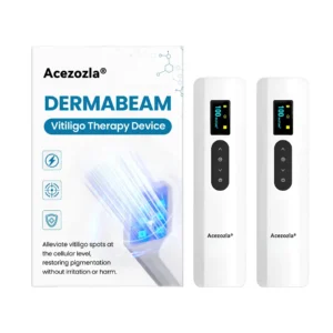 Acezozla® DermaBeam Vitiligo Therapy Device 3-5 Second Vitiligo Treatment, Visible Results in Just 2 Weeks