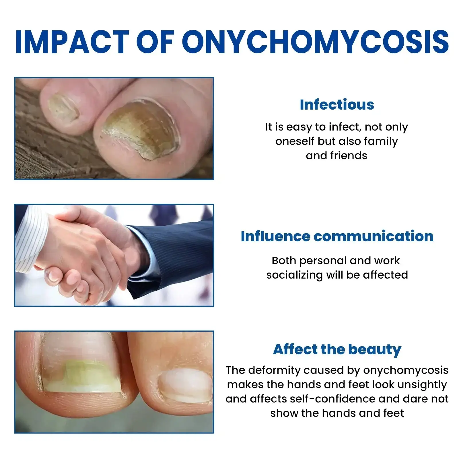 Acezozla® Fungus Nail Repair Patches