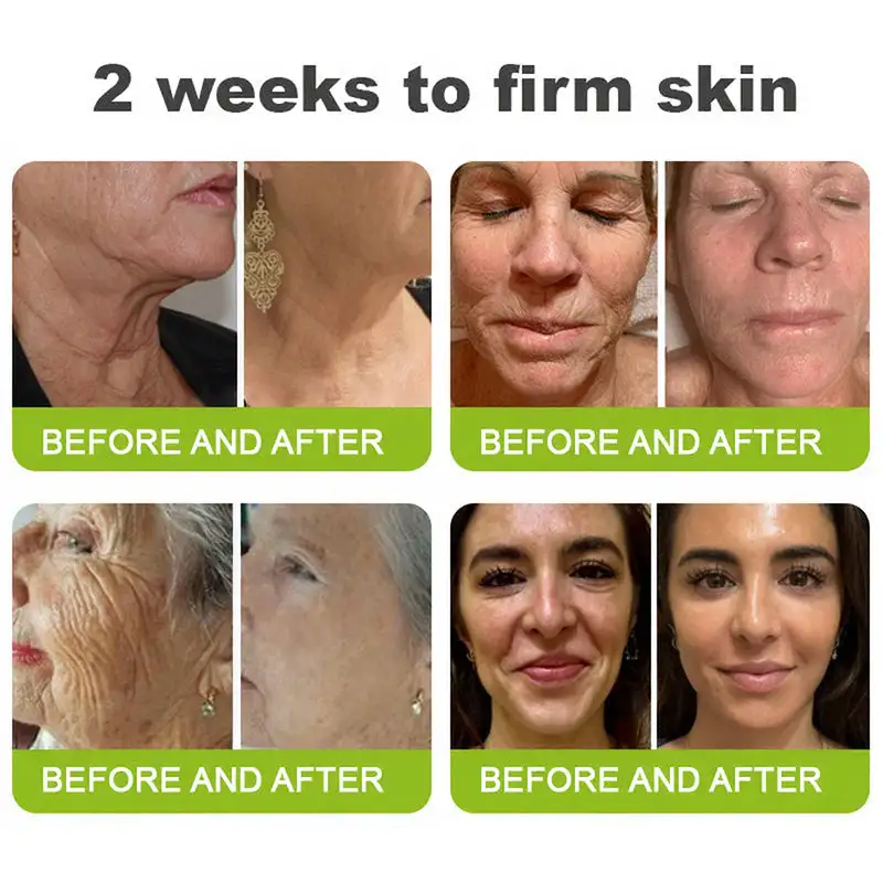 🧠👨⚕️Made and shipped from the USA 💫ACEZOZLA® Skin Tightening & Vita-A Retinol Retinol shot Anti-Wrinkle Firming Tightening cream - Last Day Promotion 70% OFF