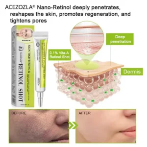 🧠👨⚕️Made and shipped from the USA 💫ACEZOZLA® Skin Tightening & Vita-A Retinol Retinol shot Anti-Wrinkle Firming Tightening cream - Last Day Promotion 70% OFF