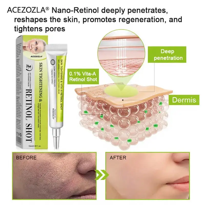 🧠👨⚕️Made and shipped from the USA 💫ACEZOZLA® Skin Tightening & Vita-A Retinol Retinol shot Anti-Wrinkle Firming Tightening cream - Last Day Promotion 70% OFF