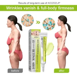 🧠👨⚕️Made and shipped from the USA 💫ACEZOZLA® Skin Tightening & Vita-A Retinol Retinol shot Anti-Wrinkle Firming Tightening cream - Last Day Promotion 70% OFF