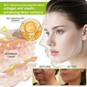 🧠👨⚕️Made and shipped from the USA 💫ACEZOZLA® Skin Tightening & Vita-A Retinol Retinol shot Anti-Wrinkle Firming Tightening cream - Last Day Promotion 70% OFF