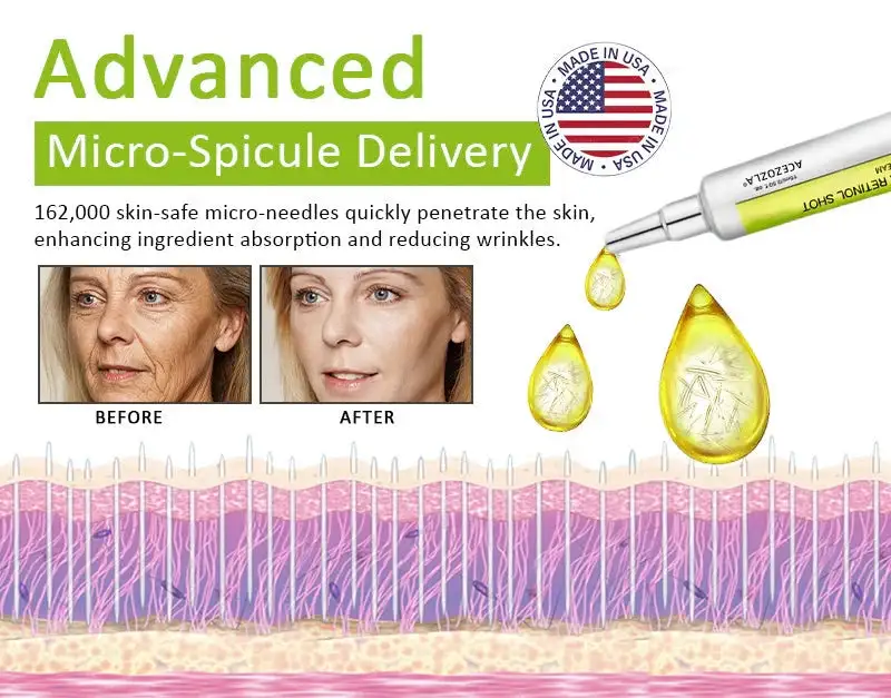 🧠👨⚕️Made and shipped from the USA 💫ACEZOZLA® Skin Tightening & Vita-A Retinol Retinol shot Anti-Wrinkle Firming Tightening cream - Last Day Promotion 70% OFF
