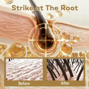 Best Seller 🎉limited-time discount | Acezozla® Hair Regrowth Capsules 💖Revive Follicles, Boost Hair Volume