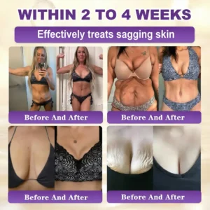 Made and Shipped from USA ✨Acezozla® Biotin 10-in-1 Skin Restoration Cream 🍀