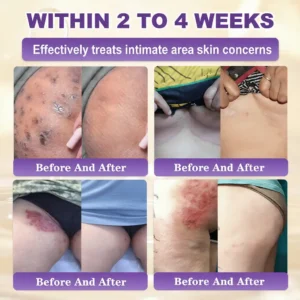 Made and Shipped from USA ✨Acezozla® Biotin 10-in-1 Skin Restoration Cream 🍀