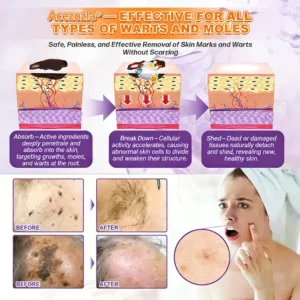 Made and Shipped from USA ✨Acezozla® Biotin 10-in-1 Skin Restoration Cream 🍀