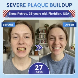 Your Smile~ Acezozla® 🦷 Tideglusib Fast‑Dissolving Tooth & Gum Repair Oral Strips ✨ (𝟓-𝐢𝐧-𝟏 💎 𝐑𝐞𝐛𝐮𝐢𝐥𝐝 𝐄𝐧𝐚𝐦𝐞𝐥 & 𝐃𝐞𝐧𝐭𝐢𝐧 • 𝐒𝐭𝐫𝐞𝐧𝐠𝐭𝐡𝐞𝐧 𝐆𝐮𝐦𝐬 • 𝐄𝐫𝐚𝐝𝐢𝐜𝐚𝐭𝐞 𝐓𝐚𝐫𝐭𝐚𝐫 & 𝐎𝐝𝐨𝐫 • 𝐖𝐡𝐢𝐭𝐞𝐧𝐢𝐧𝐠 • 𝐒𝐭𝐨𝐩 𝐓𝐨𝐨𝐭𝐡 𝐒𝐞𝐧𝐬𝐢𝐭𝐢𝐯𝐢𝐭𝐲)