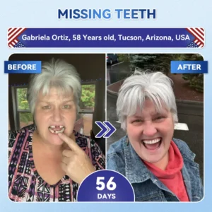 Your Smile~ Acezozla® 🦷 Tideglusib Fast‑Dissolving Tooth & Gum Repair Oral Strips ✨ (𝟓-𝐢𝐧-𝟏 💎 𝐑𝐞𝐛𝐮𝐢𝐥𝐝 𝐄𝐧𝐚𝐦𝐞𝐥 & 𝐃𝐞𝐧𝐭𝐢𝐧 • 𝐒𝐭𝐫𝐞𝐧𝐠𝐭𝐡𝐞𝐧 𝐆𝐮𝐦𝐬 • 𝐄𝐫𝐚𝐝𝐢𝐜𝐚𝐭𝐞 𝐓𝐚𝐫𝐭𝐚𝐫 & 𝐎𝐝𝐨𝐫 • 𝐖𝐡𝐢𝐭𝐞𝐧𝐢𝐧𝐠 • 𝐒𝐭𝐨𝐩 𝐓𝐨𝐨𝐭𝐡 𝐒𝐞𝐧𝐬𝐢𝐭𝐢𝐯𝐢𝐭𝐲)