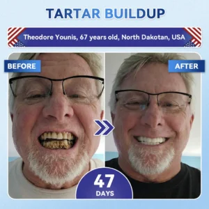 Your Smile~ Acezozla® 🦷 Tideglusib Fast‑Dissolving Tooth & Gum Repair Oral Strips ✨ (𝟓-𝐢𝐧-𝟏 💎 𝐑𝐞𝐛𝐮𝐢𝐥𝐝 𝐄𝐧𝐚𝐦𝐞𝐥 & 𝐃𝐞𝐧𝐭𝐢𝐧 • 𝐒𝐭𝐫𝐞𝐧𝐠𝐭𝐡𝐞𝐧 𝐆𝐮𝐦𝐬 • 𝐄𝐫𝐚𝐝𝐢𝐜𝐚𝐭𝐞 𝐓𝐚𝐫𝐭𝐚𝐫 & 𝐎𝐝𝐨𝐫 • 𝐖𝐡𝐢𝐭𝐞𝐧𝐢𝐧𝐠 • 𝐒𝐭𝐨𝐩 𝐓𝐨𝐨𝐭𝐡 𝐒𝐞𝐧𝐬𝐢𝐭𝐢𝐯𝐢𝐭𝐲)