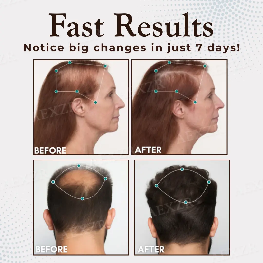 Acezozla™ Hair Regrowth Capsules💊Support Fast Hair Growth & Thicker Looking Hair✨