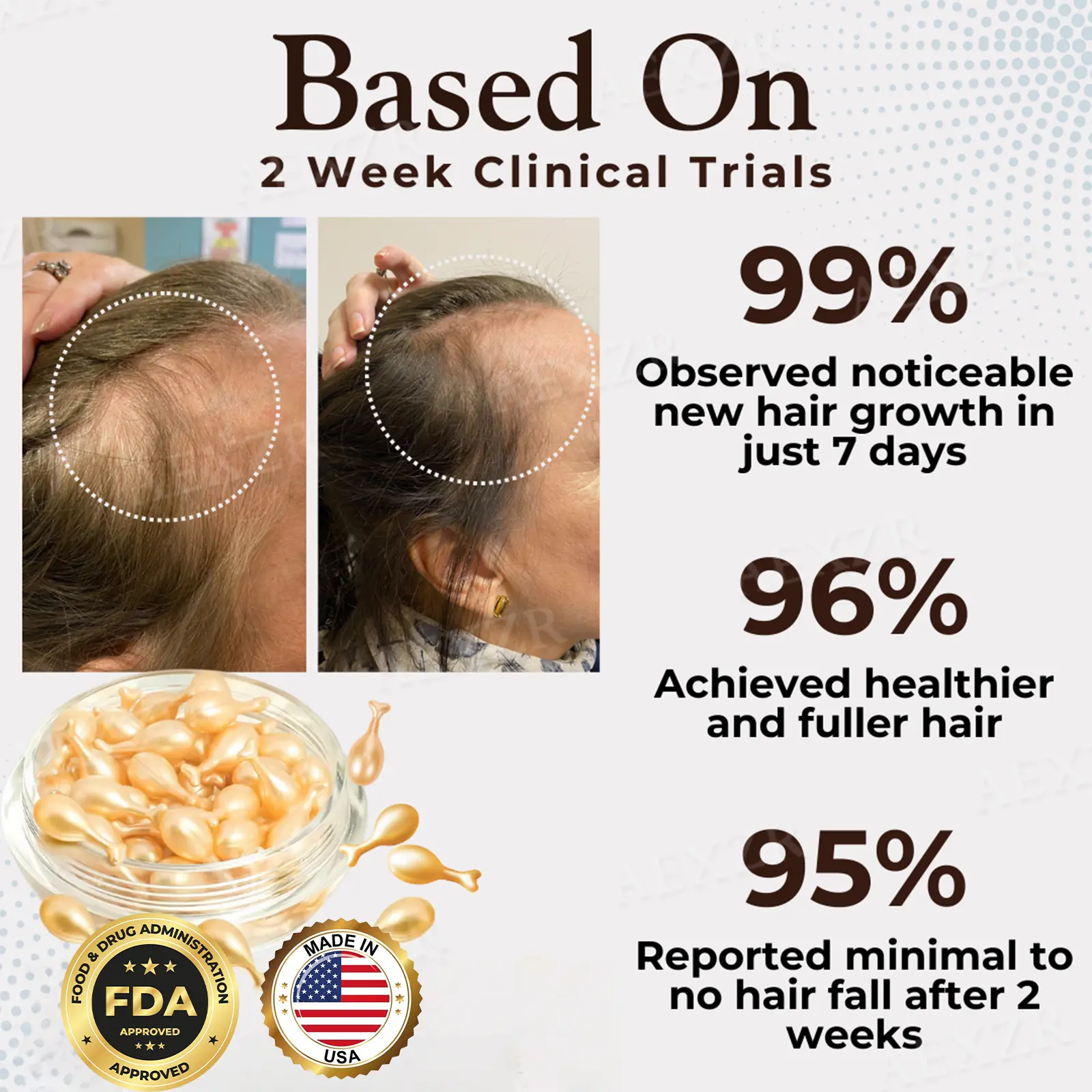 Acezozla™ Hair Regrowth Capsules💊Support Fast Hair Growth & Thicker Looking Hair✨