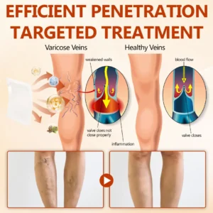 🔥 LIMITED SPECIAL OFFER🔥Acezozla® VeinRepair Microneedle Patch Roll (Advanced Microneedle Vein Repair Patch for Bulging Veins, Swelling, Heavy Legs & Daily Leg Discomfort)
