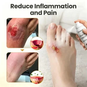 Acezozla® GlucaVeil 24H Foot Barrier Spray