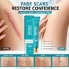 Acezozla® Repair Scar Cream-Powerful repair, without leaving any trace