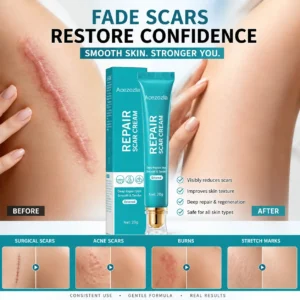 Acezozla® Repair Scar Cream-Powerful repair, without leaving any trace