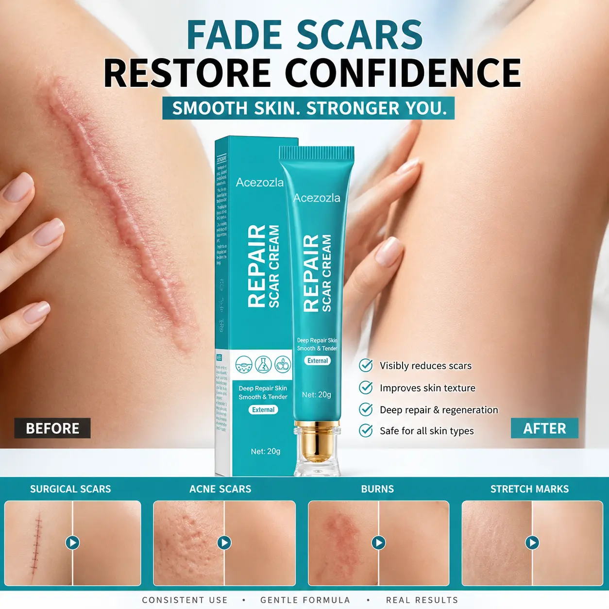 Acezozla® Repair Scar Cream-Powerful repair, without leaving any trace