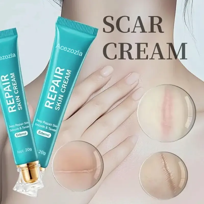Acezozla® Repair Scar Cream-Powerful repair, without leaving any trace